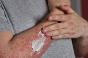 Anaphylaxis Awareness Training